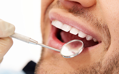 Man doing teeth checkups