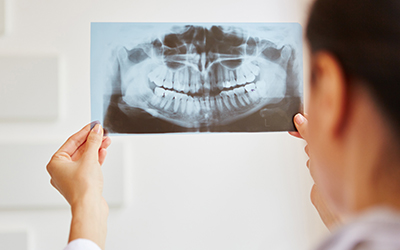 A dentist looking at an x-ray