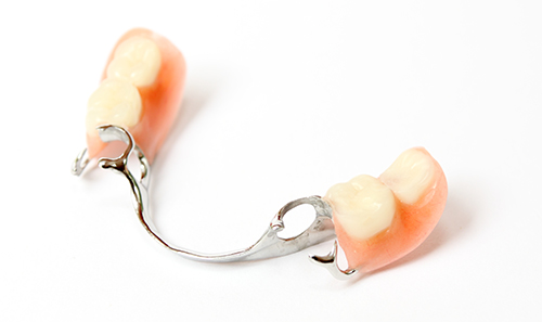 Sample of partial dentures