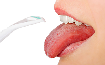 Tongue hygiene