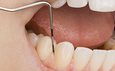 Gum health