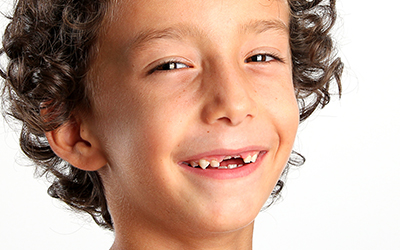 A young boy missing teeth