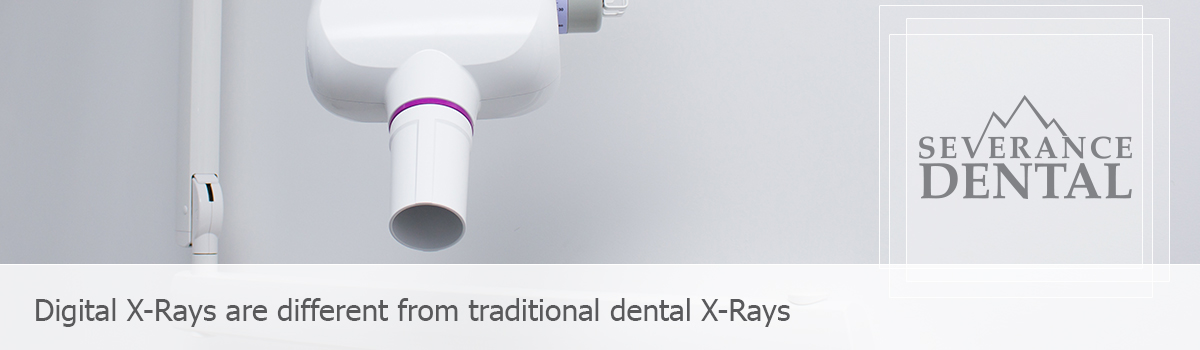 Dental x-ray, Digital X-Rays are different from traditional dental X-Ray.